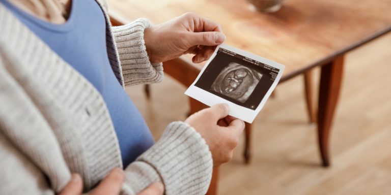 Schwangere Frau hält ein Ultraschall-Bild in der Hand