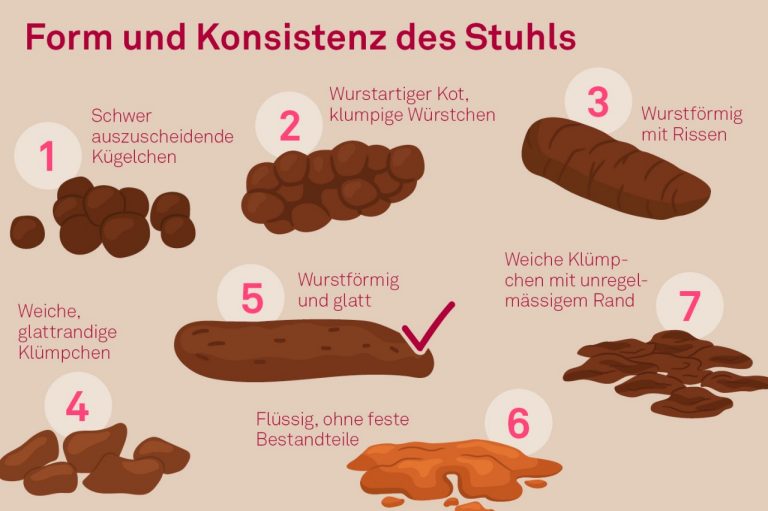Form und Konsistenz des Stuhls